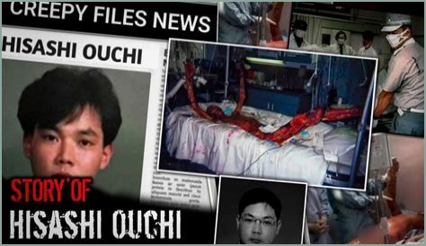 **The Remarkable Journey Of Hisachi Ouchi After Radiation**